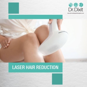 Laser Hair Removal Cost in Bangalore